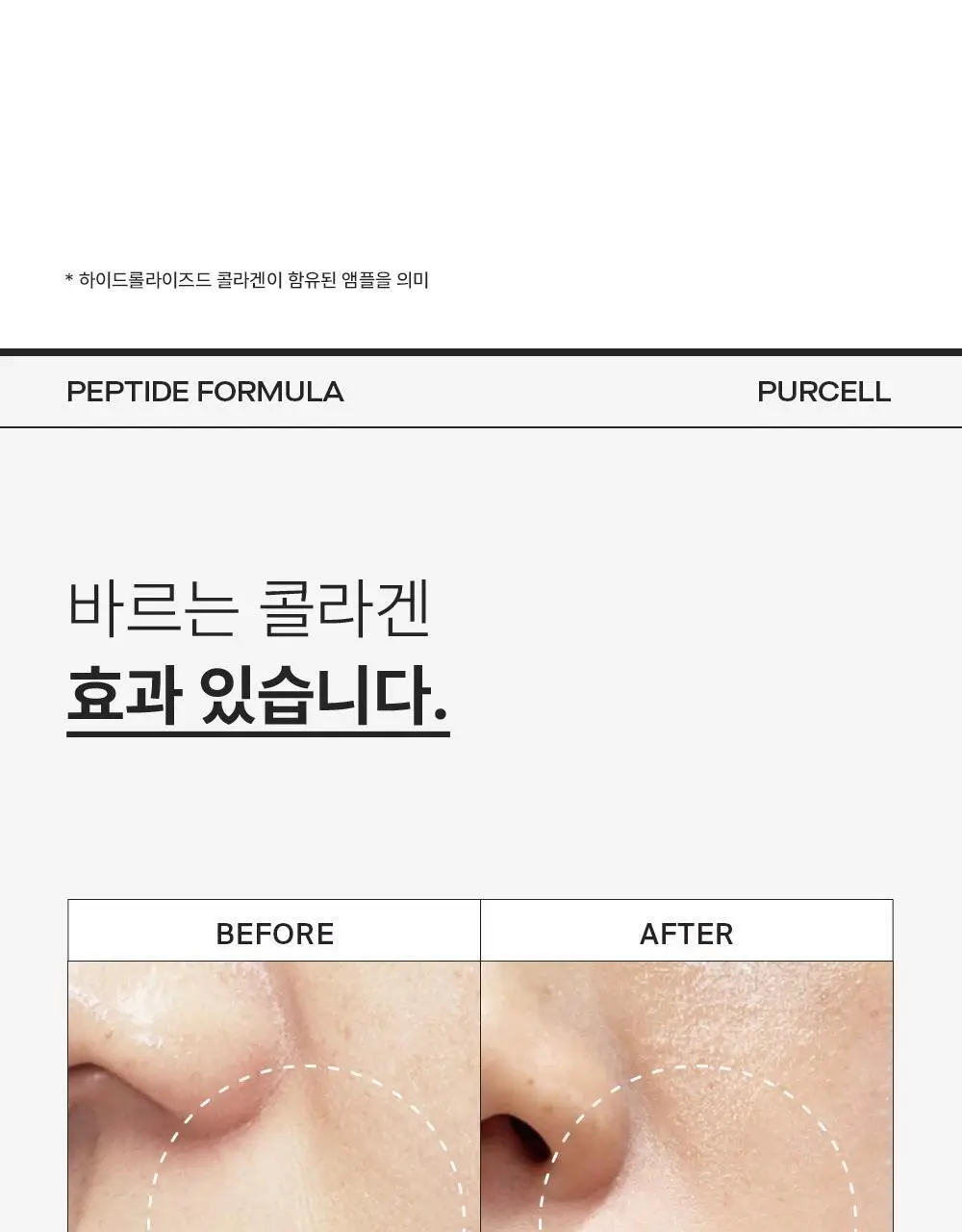 [주름리프팅] 퍼셀 82% 하이-도즈 펩타이드 콜라겐 앰플 20ml 상세페이지 6